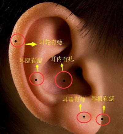 右耳下有痣|耳朵长痣的位置图解 耳朵长痣的位置图解有福气